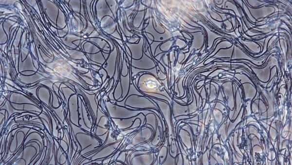 La resistenza agli antibiotici è una minaccia al genere umano