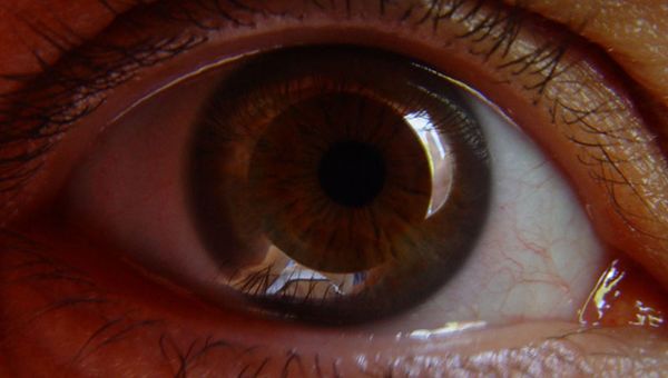 A Pisa primo trapianto al mondo di protesi retinica
